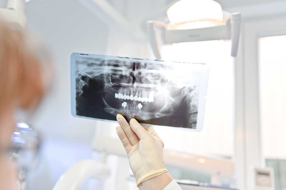 Root Canal Therapy Treatment Specialist