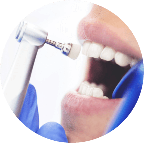 Teeth Cleaning in Bowmanville, ON