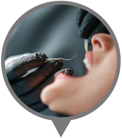 Bowmanville Dental Hygiene Services