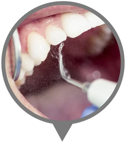 Professional Teeth Cleaning Bowmanville